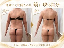 ムーン(MOON)/後ろ姿が変わる痩身