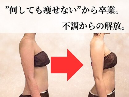 ビーエムビー(BMB)の写真