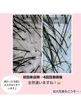 モモ 札幌(MOMO.)/育毛促進スパ