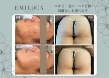 エミルカ(EMILUCA)