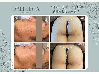 エミルカ(EMILUCA)