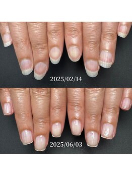 ココ(COCO)/ハンドケア・ネイルケア・自爪