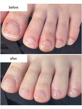 ケアプラス(care plus)/フットネイルケア