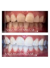 佐賀ホワイトニングラボ/