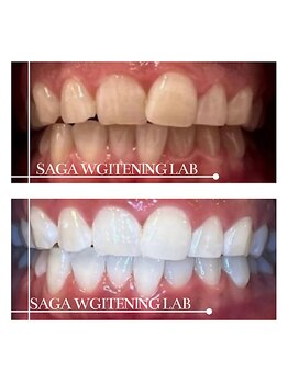 佐賀ホワイトニングラボ/