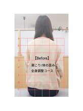 おざき整体院/肩こり/体のゆがみ/全身調整