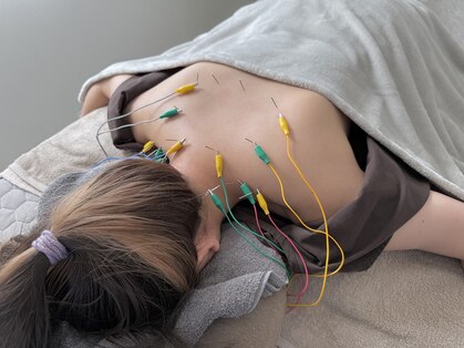 美容鍼&鍼灸サロン 鍼Glitter. 岡山駅前店【3月開店(予定)】の写真