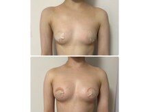 ルナグランデ(Luna grande.)の雰囲気（京都最新“バストアップ”専門サロン増える豊胸術）