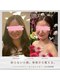 マリーズウィル(MARY's WILL)の写真/削らない小顔。骨格から整えフェイスライン劇的スッキリ！左右差・むくみを改善し、理想の自分を叶える。