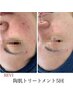 ざらつき毛穴、ニキビケア◎くすみ一掃疲れ顔リセット♪つるん肌ハーブ18,700