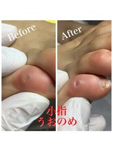 プラスキュア 用賀店(+CURE)/タコうおのめケア60分￥6600～