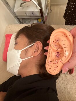 ダイエットパーソナルサポーター美魅の写真/なかなか痩せられなかった方におすすめ！結果重視の耳つぼ施術と食事指導で、短期間で痩せたい方に★