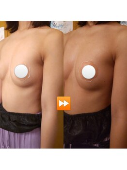 エステティックサロン やまとなでしこ/バストの細胞活性がアップ!!