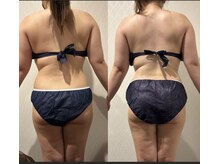 ワイグレイス(Y.GRACE)/ヴィーナスディーバ（4D痩身）