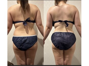 ワイグレイス(Y.GRACE)/ヴィーナスディーバ（4D痩身）