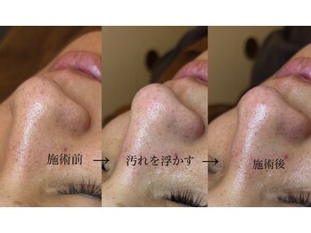 オアシス メイエキ(Oasis ｍeieki)/【メンズフェイシャル】