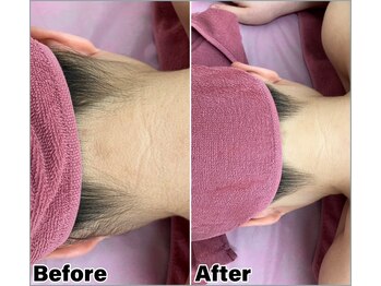 ベルミーランド MEGAドン・キホーテ草加/えり足Before→After