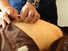 桜上水駅南整体院/鍼