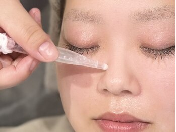 ルミエール 札幌大通parkside店の写真/押し出さない“３D毛穴ケア” 「溶かして吸い取る」顎や小鼻のざらざらもつるつる◎化粧ノリが抜群のお肌に