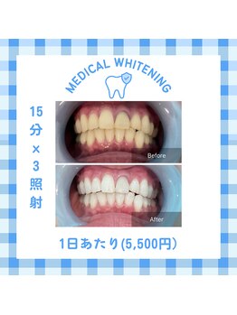 ベルプラス 新大阪(Belle plus)/Belle plus のホワイトニング