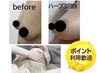 【垂れ乳バストアップ】ハーブピーリングバスト90分+美乳バストケア90分