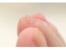 爪の厚みを削る必要がある場合は