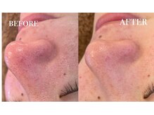 メナードフェイシャルサロン 中萩/