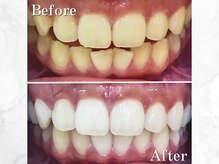 LBSホワイトニング 銀座店/空いた時間でホワイトニング◎