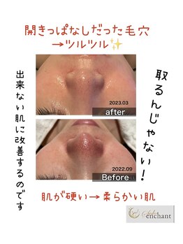 インチャント(enchant)/硬くなってしまった毛穴ケア