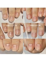 ニコプラス(NICO+)/爪育ネイルケア