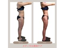 トレゾアスィス(Tresor sis)の雰囲気（人気のメディセル痩身☆痛みが少ない筋膜リリースでサイズダウン）