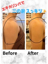 ミエル(Miel)/Before After