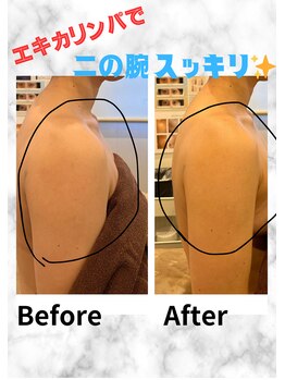 ミエル(Miel)/Before After