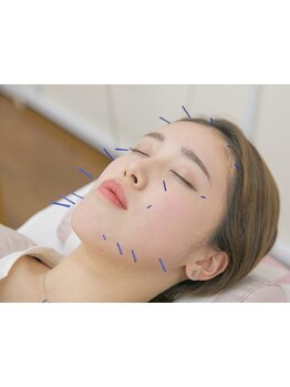 小顔になりたい