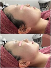 プリマプリート 各務原店/驚異の小顔リンパ！