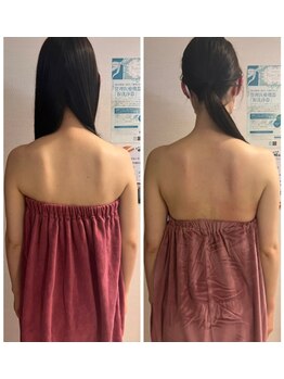 ロココ 豊田店(Rococo)/ビフォーアフター