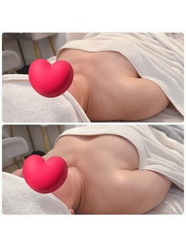 エステティックステラ(esthetic stella)/《40代のお客様》