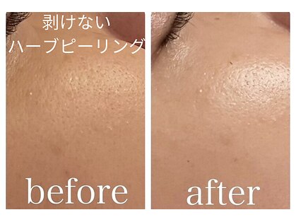 イルソーレ(IL Sole)の写真