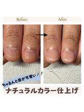 ブルームブルーム(BLOOMブルーム)/深爪矯正ナチュラルカラー仕上げ