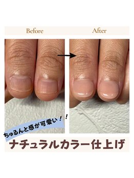 深爪矯正ナチュラルカラー仕上げ