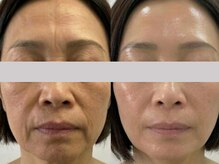 ミロク(369)/あなたも半年後のこうなれる♪