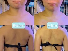 温和活 ロータス(温和活Lotus蓮:)/オイルリンパマッサージ施術変化