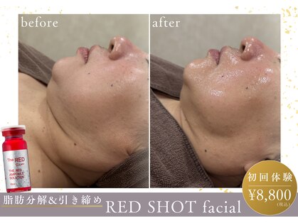 ナチュールファースト(naturel first)の写真