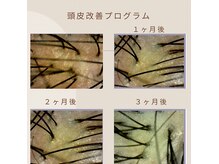 プテア(Phteah)の雰囲気(かゆみ、フケ、ベタつき、ニオイ等の頭皮ケアもお任せください。)