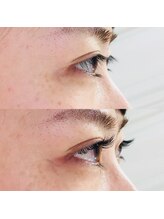 ルピナス 武蔵小金井店(Lupinus)/アップワードラッシュ140本