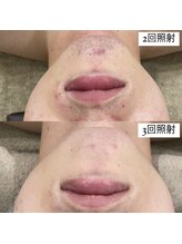 テンパ ビューティー(+10%beauty)/効果写真