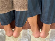 チアーライフ整体/整体/骨盤矯正の効果/マッサージ