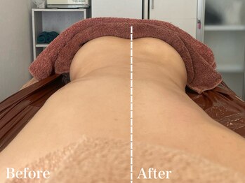 サロンドフェイス(Salon de Faith)/【筋膜リリース】1回施術♪