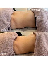 ブルーム(bluem)/下腹部ぺったんこ！