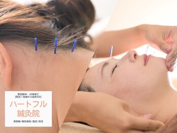 ハートフル鍼灸院の写真/≪大人気!鍼灸師のマッサージ付≫顔+首肩の同時施術が好評♪骨盤矯正・姿勢改善も鍼とセットで早期緩和に◎